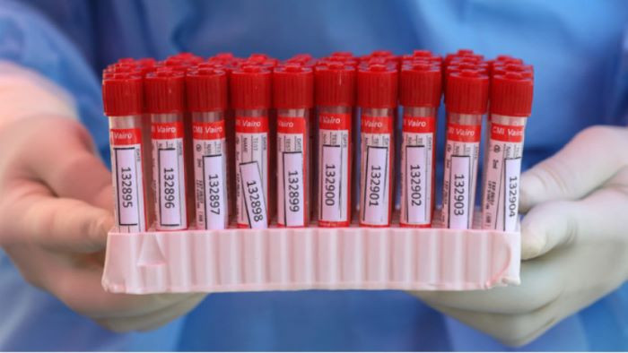 130 са новите случаи на коронавирус у нас за последното